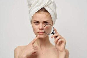 Acne tipos causas e tratamentos